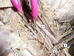 newcr2img1