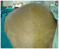 newcr2img1